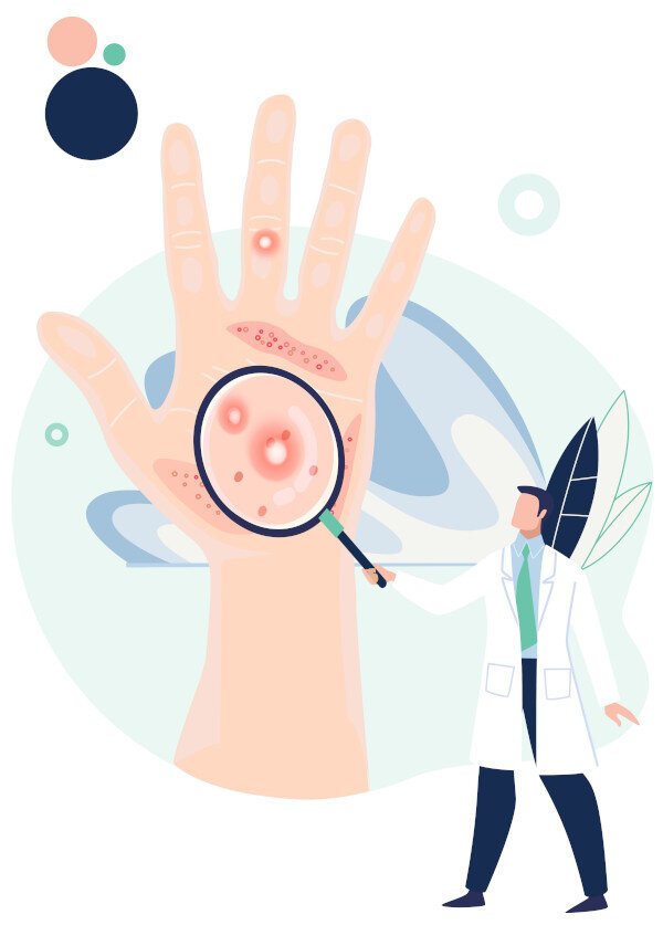 Derma-Point Cheratosi Attinica Derma-Point Cheratosi Attinica