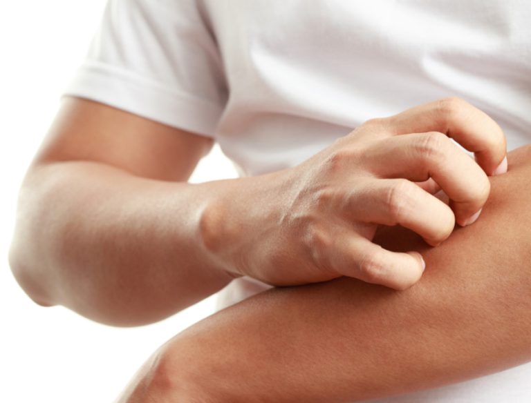 Foto come alleviare il prurito da psoriasi