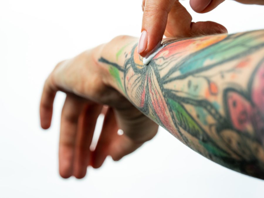 Psoriasi e tatuaggi