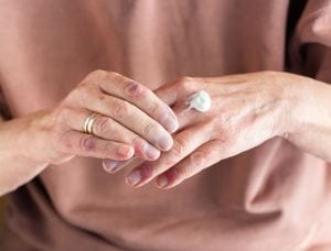 Come curare la dermatite atopica