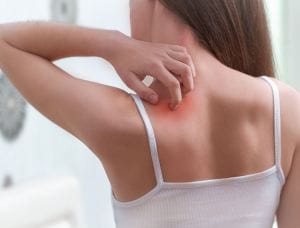 Celiachia e psoriasi