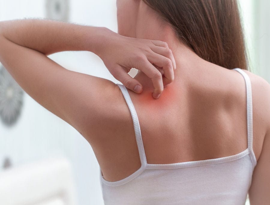 Celiachia e psoriasi