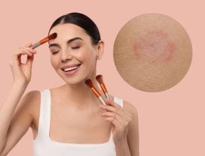 Come truccarsi con la dermatite atopica