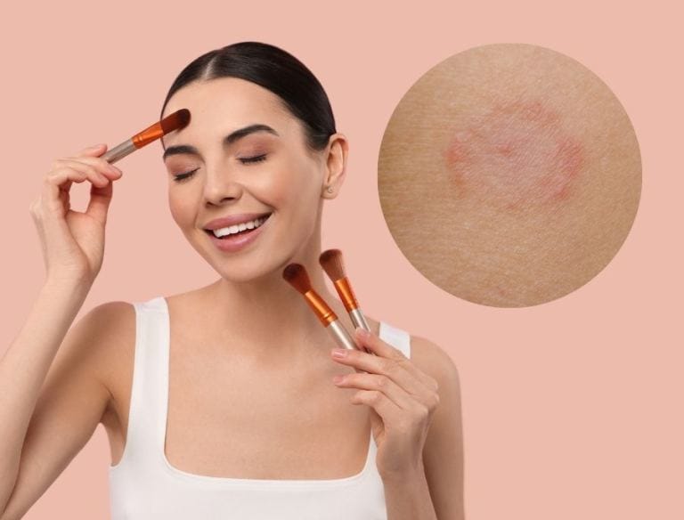 Come truccarsi con la dermatite atopica