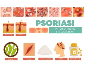 Psoriasi cause