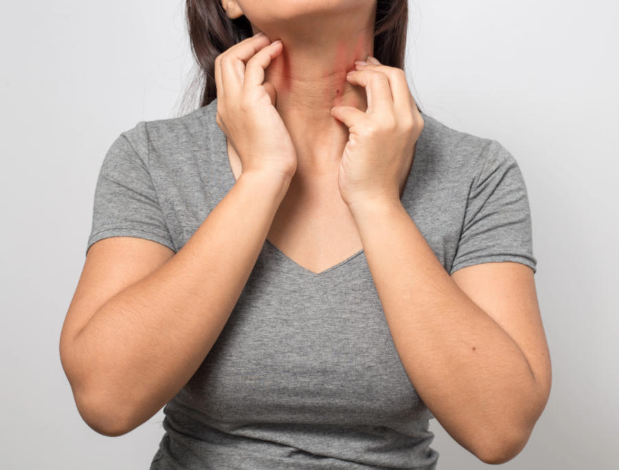 Dermatite atopica e tiroiditi autoimmuni